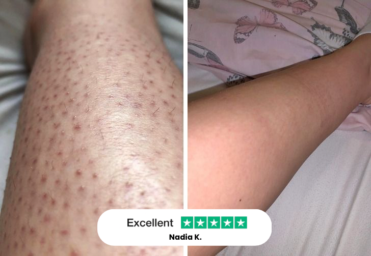 HeySilkySkin