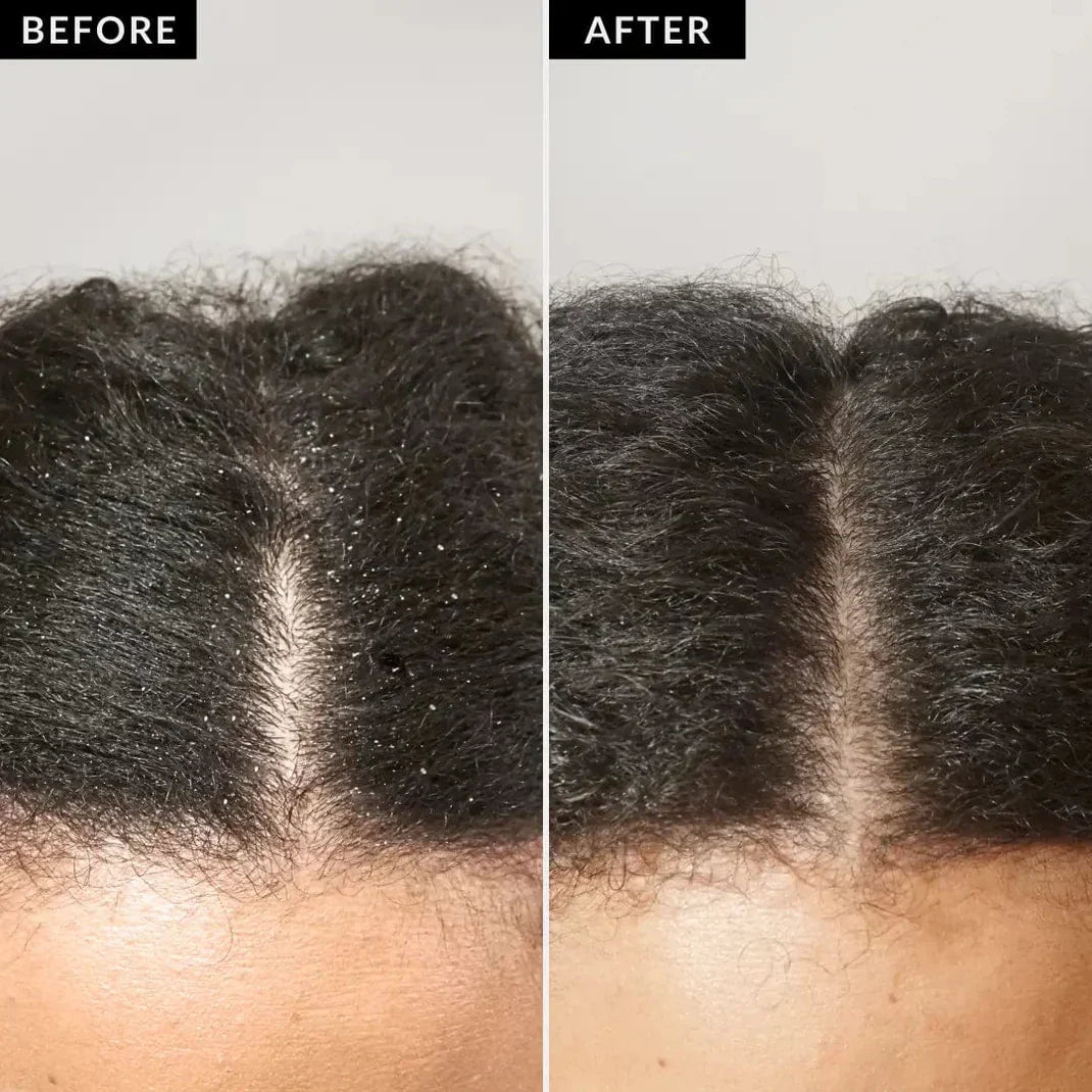 EXFOLIA™ Scalp Detox Comb