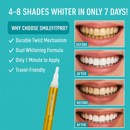 SmileFitPro™ - Teeth Whitening Serum Pen