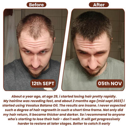 Batana™ Natural Hair Growth Oil