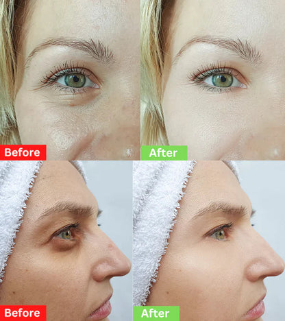 CELYN: Youthful Gaze Eye Cream